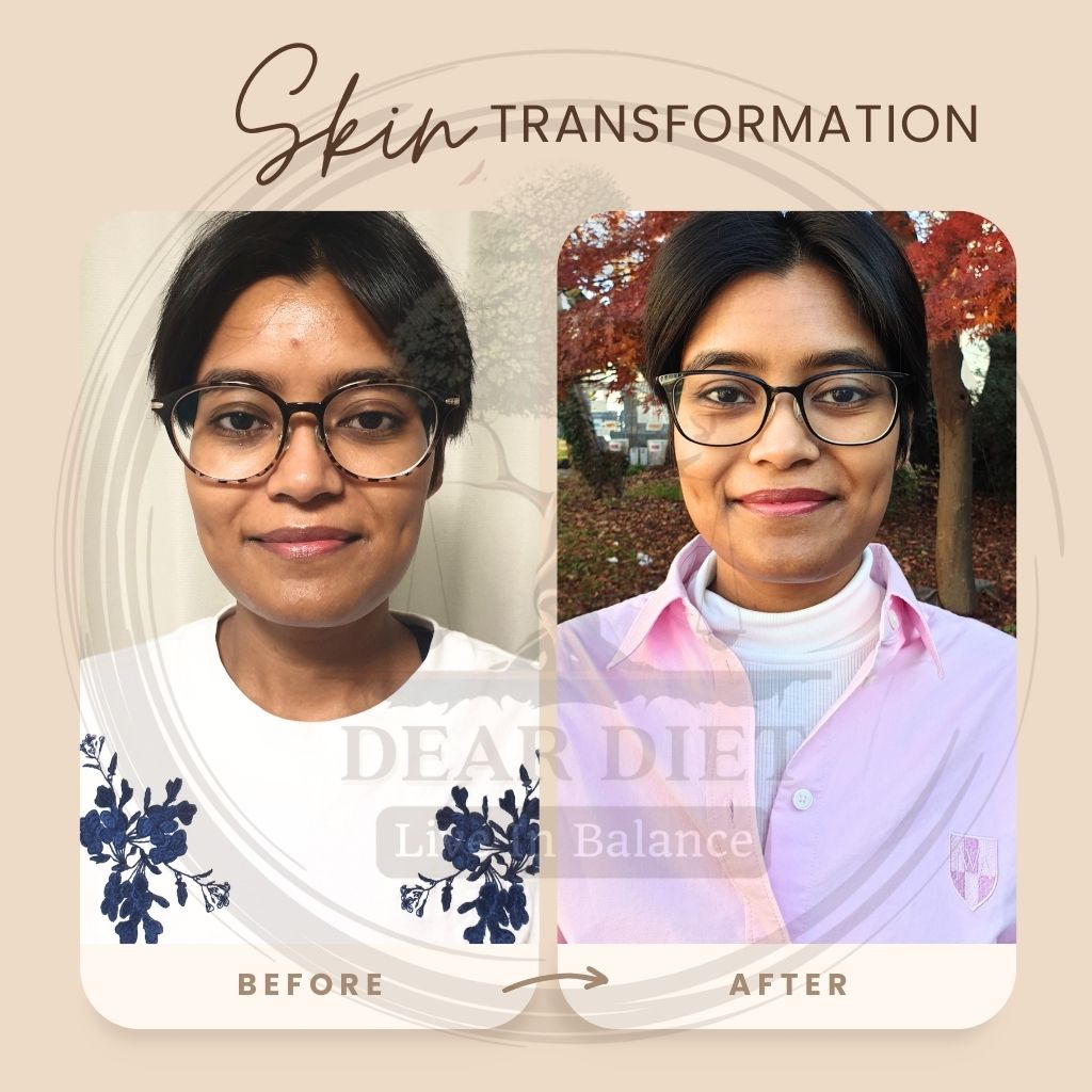 Skin Transformation