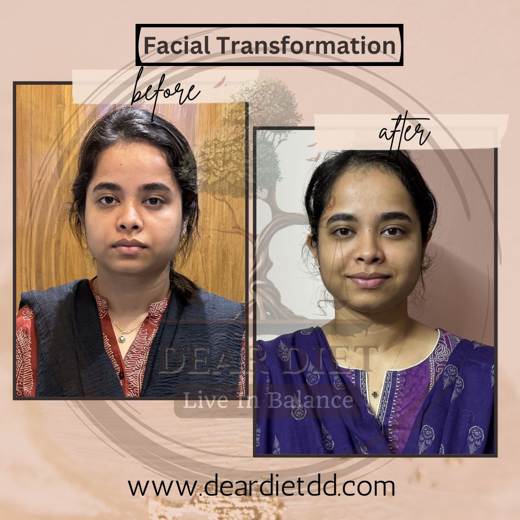 Facial Transformation Before-After